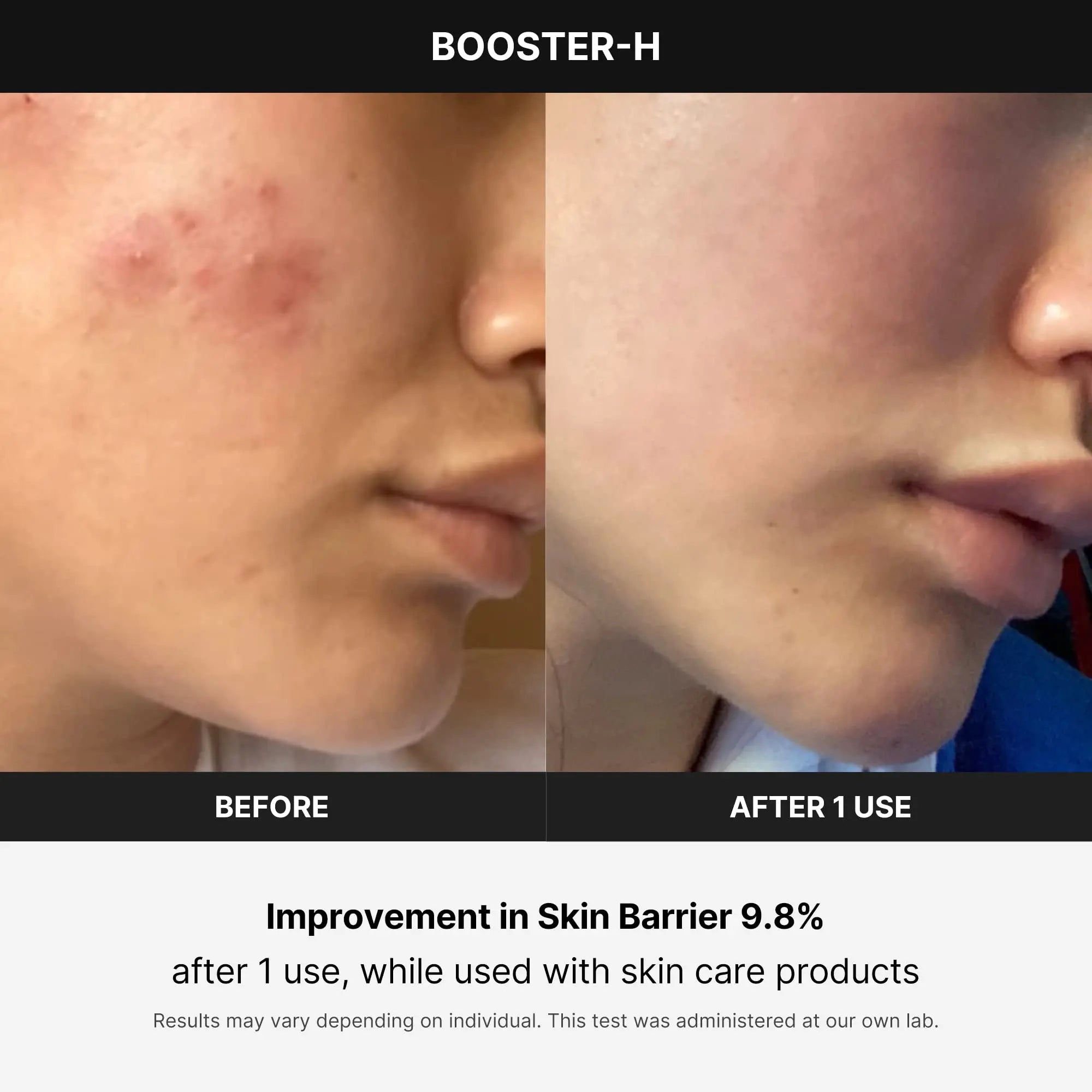 Age R Booster H Before and After