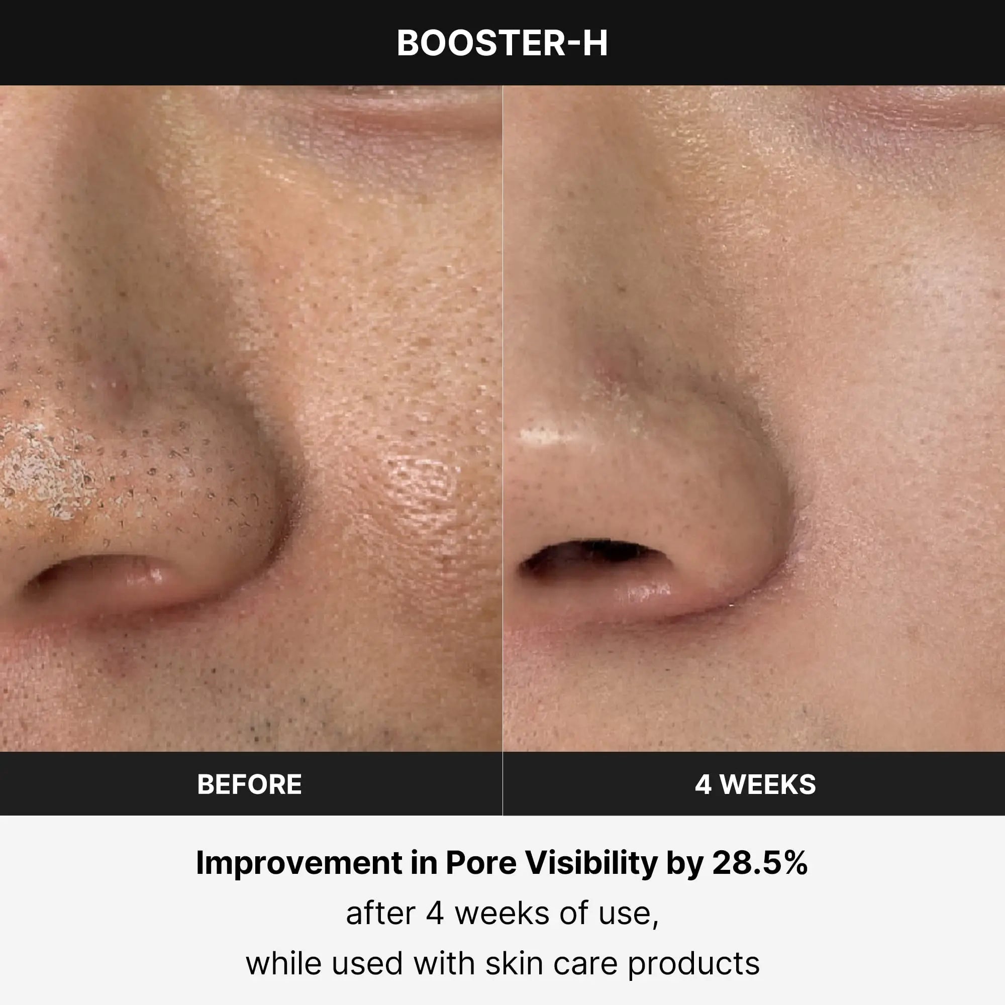 Age R Booster H Improvement in Pore Visibility